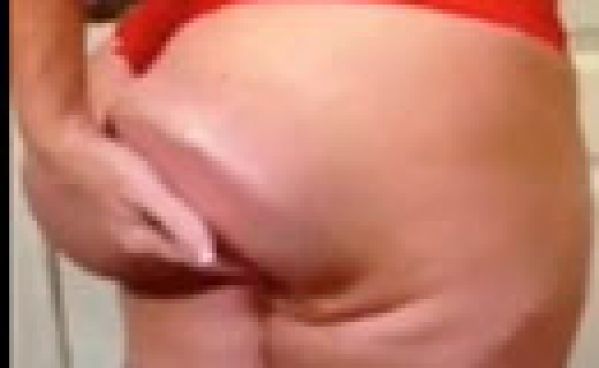 Les implants fessiers les plus ratés! Les implants fessiers les plus ratés!