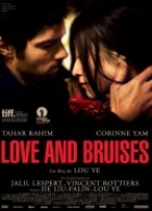 Love and bruises