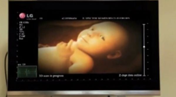 LG piège des parents pendant une échographie