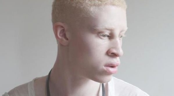 Shaun Ross : le premier mannequin albinos s’exprime sur les standards de beauté