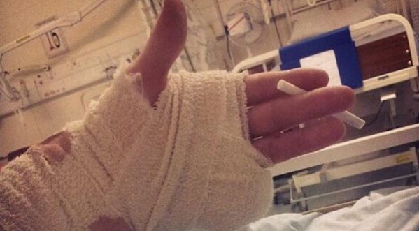 Un adolescent perd son doigt pendant une rave et continue de faire la fête car « il y avait beaucoup de filles » !