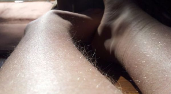 Hairy Legs Club  : Elles ont décidé d’arrêter de s’épiler !!