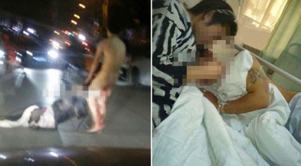 Une femme trompée en Chine coupe deux fois le pénis de son mari pour se venger!