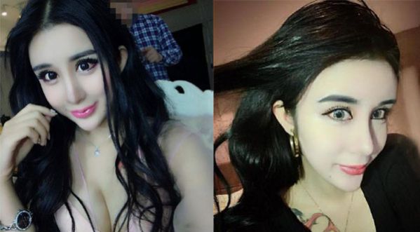 Elle n’a que 15 ans et a déjà subi de nombreuses interventions de chirurgie esthétique !!!