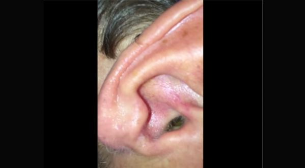 Mais qu’est-ce qui habite l’oreille de cet homme ?!