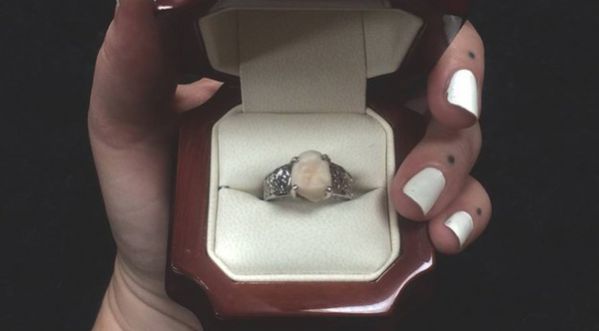 Une bague de fiançailles avec une dent de sagesse !