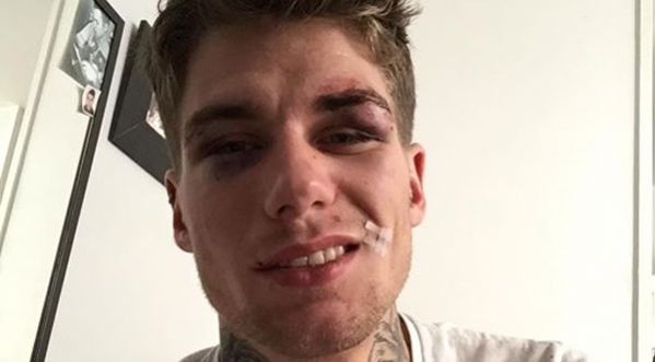 Agression homophobe, il témoigne !