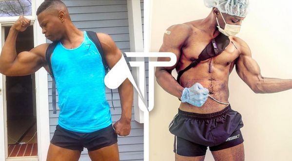 Incroyable: Cet homme s’est construit un corps d’athlète en ayant un coeur artificiel !