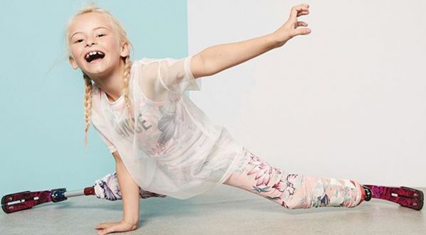 A 8 ans et sans jambes, Daisy devient modèle !
