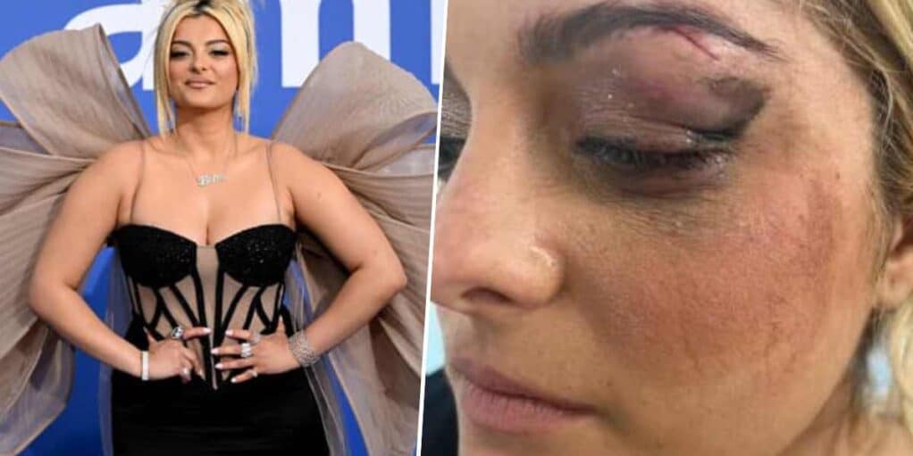 Bebe Rexha s'effondre sur scène à cause d'un fan !