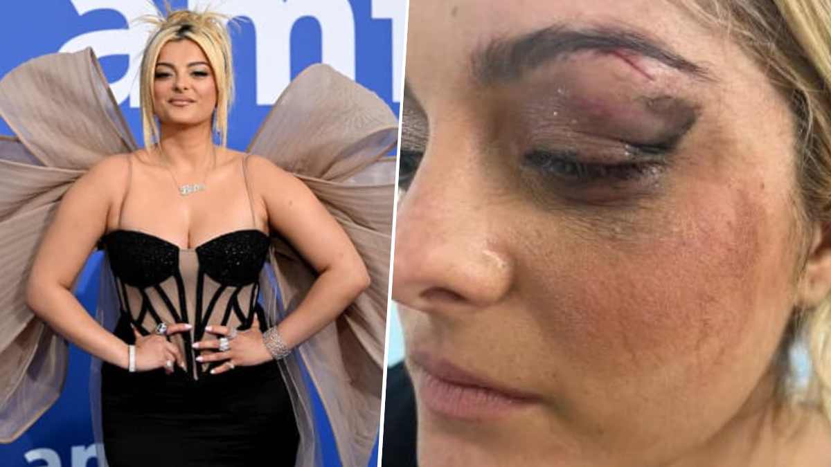 Bebe Rexha s'effondre sur scène à cause d'un fan !