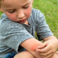 Petits bobos de l'été : prévenir et soulager les désagréments en vacances