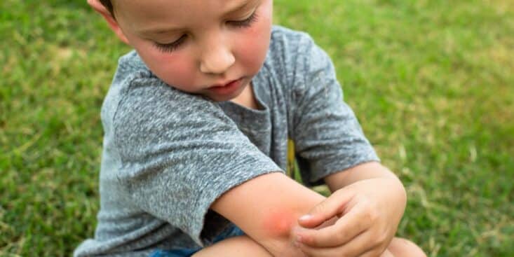 Petits bobos de l'été : prévenir et soulager les désagréments en vacances